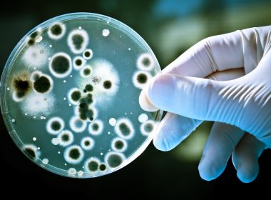 petri dish with mould antibiotic resistance A\J AlternativesJournal.ca